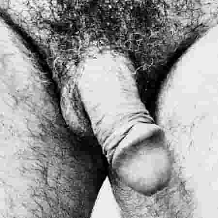 Penis Galerisi. Şekil - 1