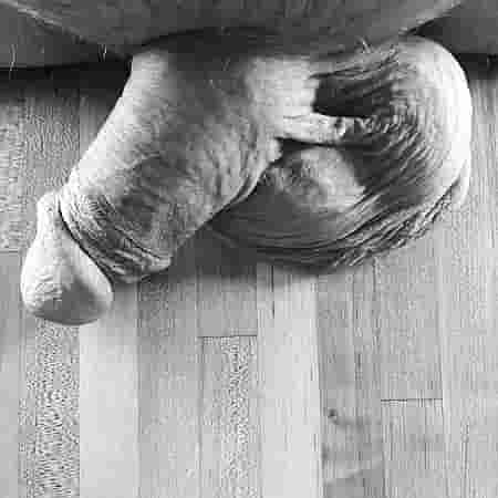 Penis Galerisi. Şekil - 8
