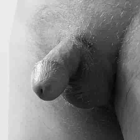 Penis Galerisi. Şekil - 10